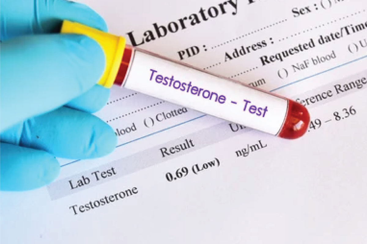 Potential Benefits Of Testosterone Therapy As You Age In Life